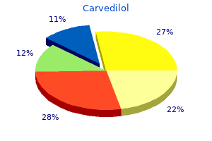 discount 12.5 mg carvedilol overnight delivery